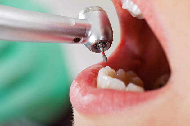 Best Pediatric Emergency Dentist in Mountain Home, AR